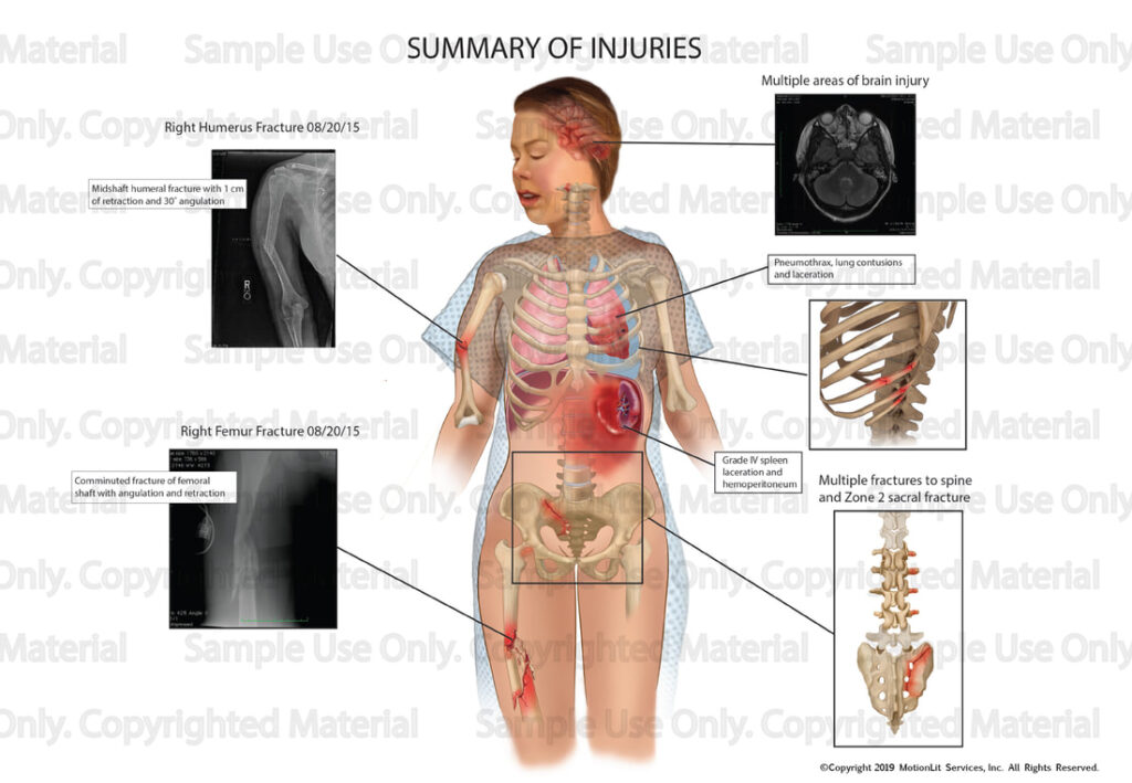 illustration-samples-summary-of-injuries-01_orig
