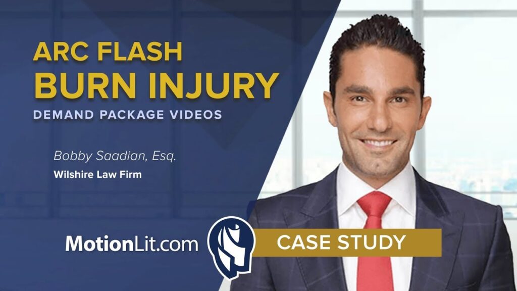 Demand Video Conveys Worker’s Burn Injury Claim By Facility Negligence Resulting In A Substantial Outcome