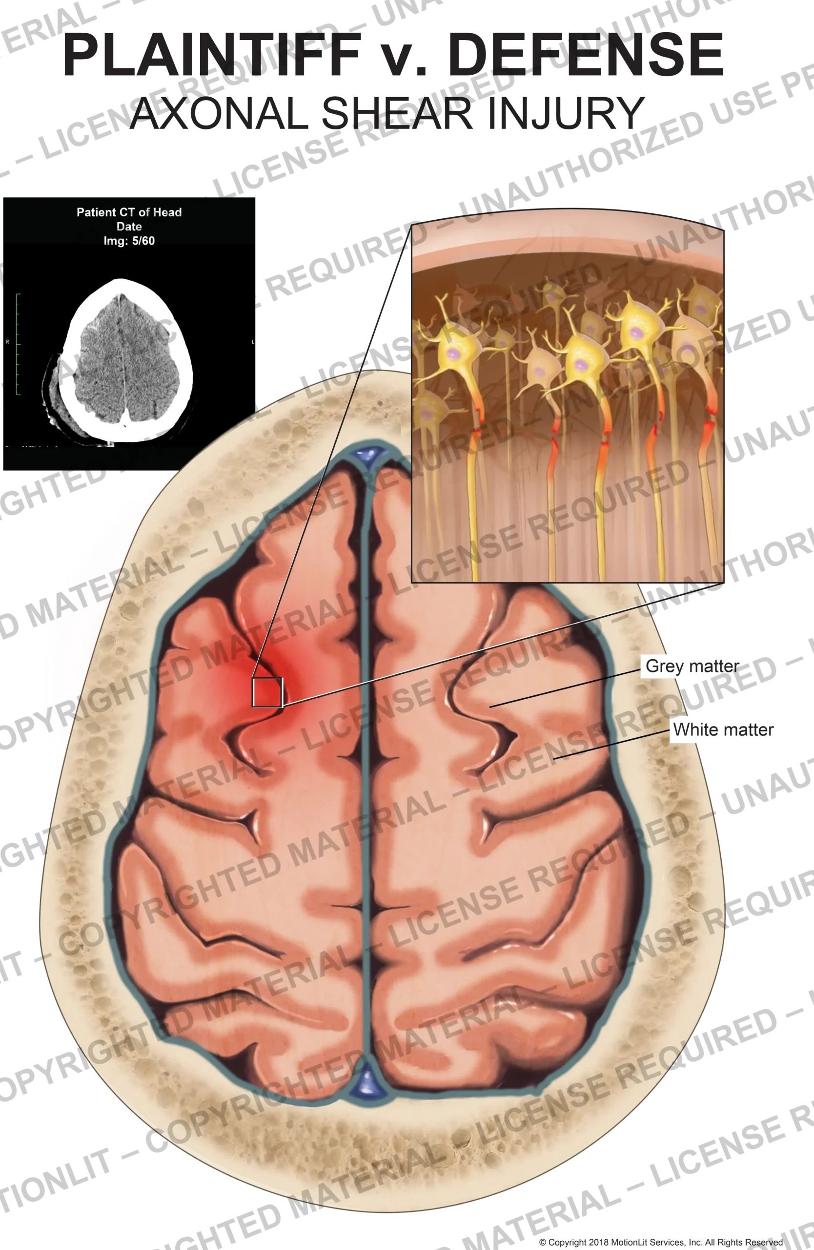 Brain Cross Section