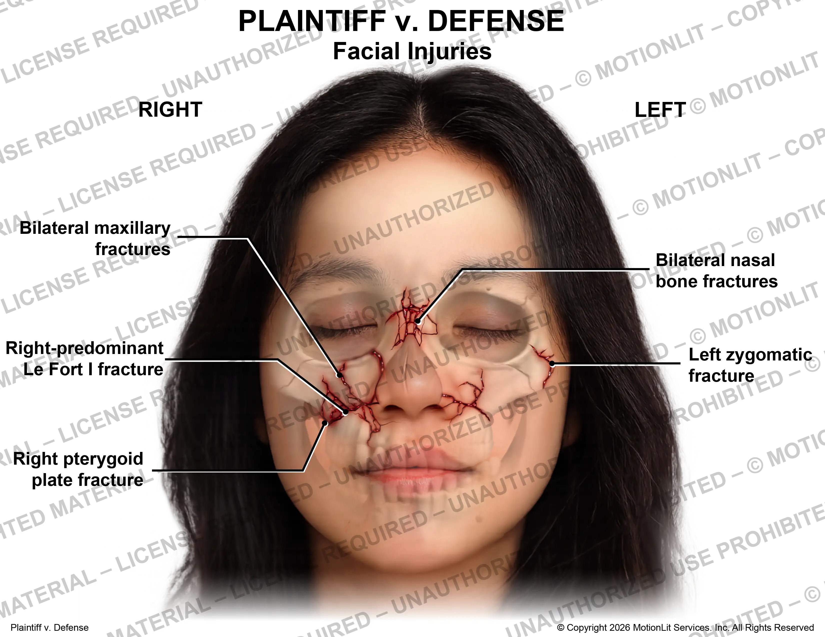 Face Injuries Female