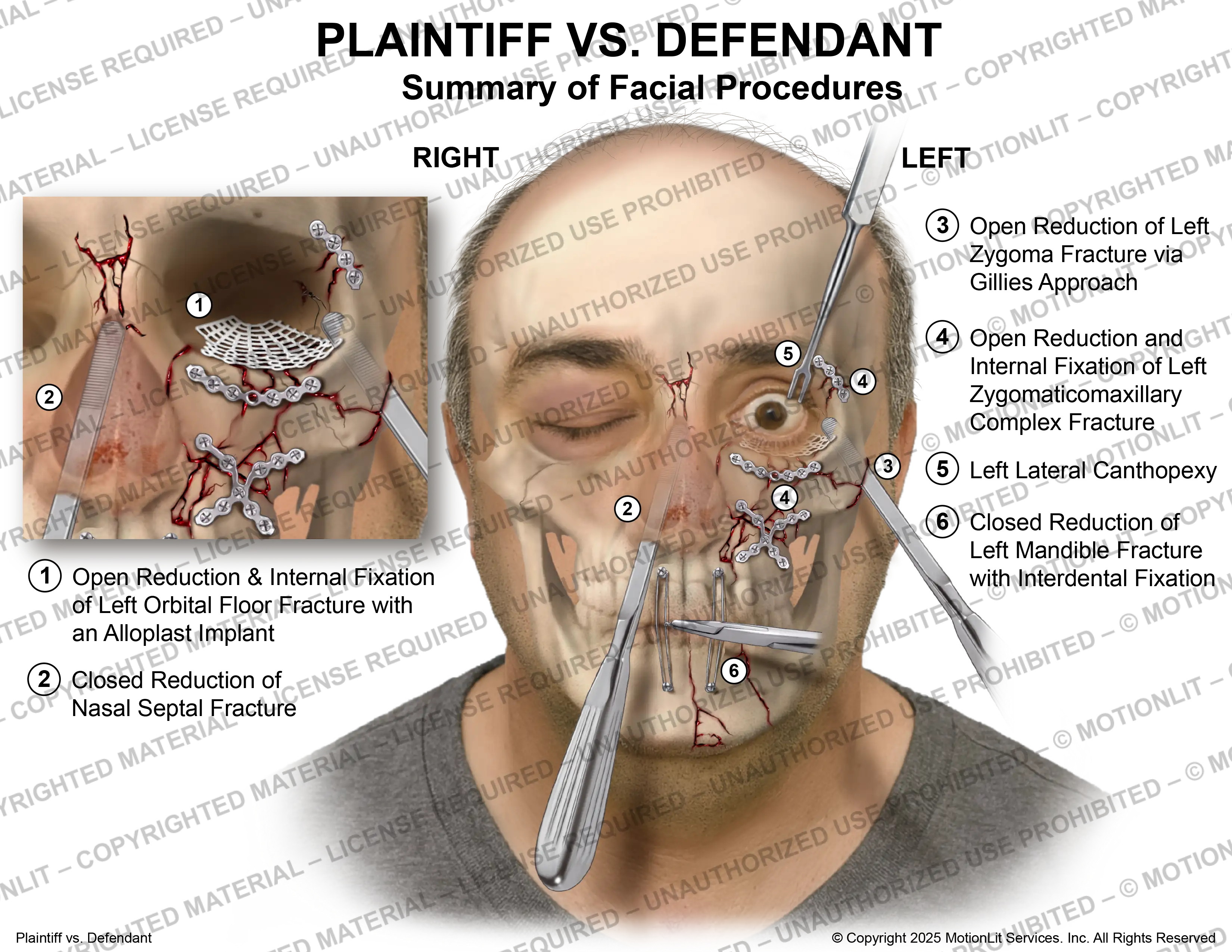 Face Surgeries