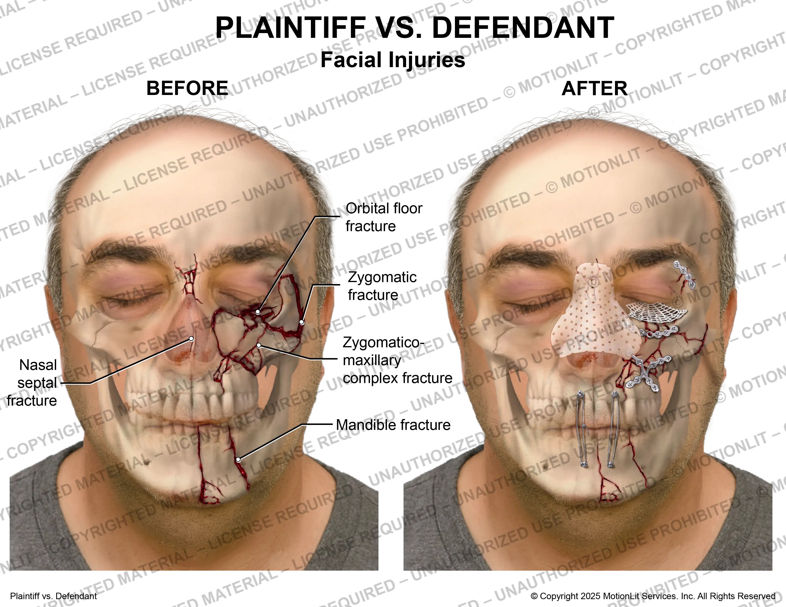 Face Injuries Male