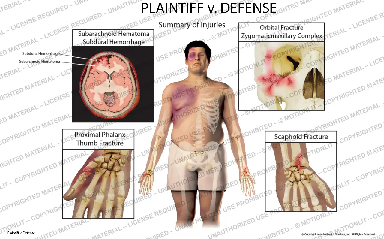 Medical Illustration