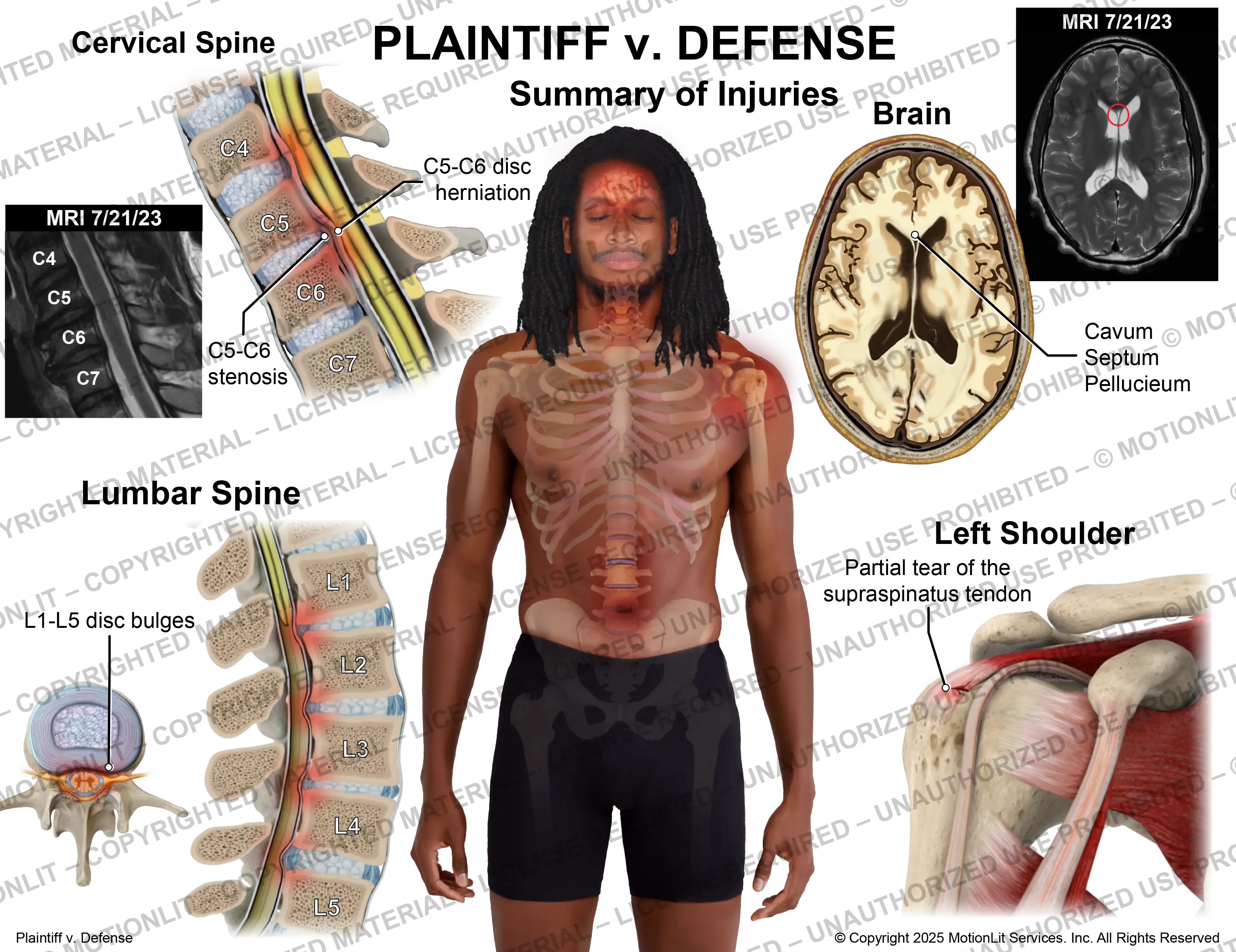 Summary of Injuries