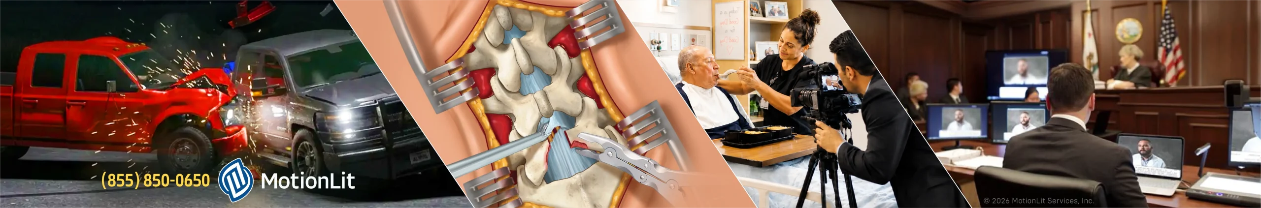 MotionLit litigation exhibits: accident reconstruction animation, surgical medical illustration, day in the life video production and courtroom trial support