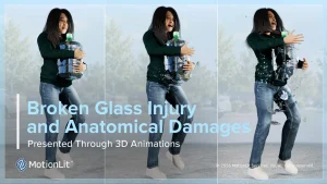 Mechanism of injury animation still showing broken glass cutting into the wrist, used as a product liability trial exhibit